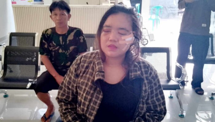 Ibu Muda di Tanggamus Alami Penyiksaan Brutal oleh Suami Siri, Bola Mata Ditekan dan Disayat Pisau